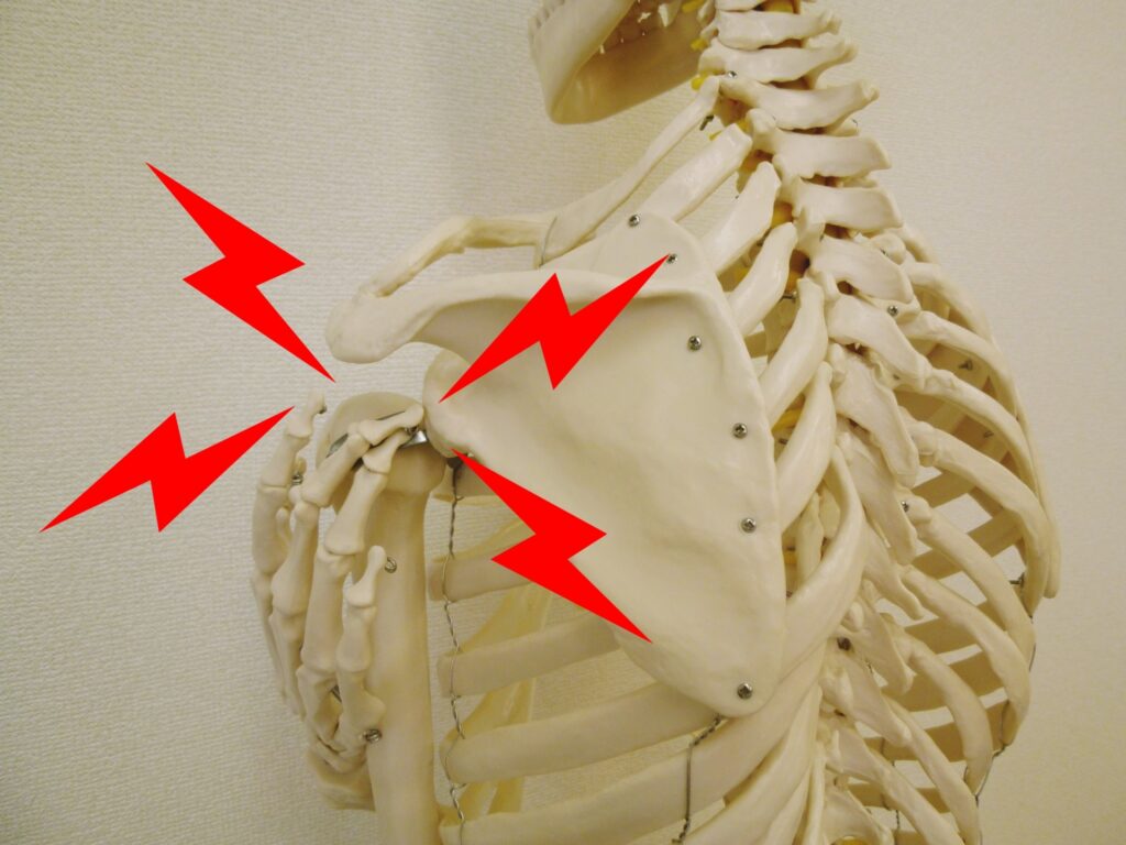 四十肩・五十肩・肩の痛みに関する画像